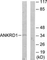 CARP / ANKRD1 Antibody - Western blot analysis of lysates from COLO205 cells, using ANKRD1 Antibody. The lane on the right is blocked with the synthesized peptide.