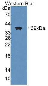 CARP / ANKRD1 Antibody - Western Blot; Sample: Recombinant protein.