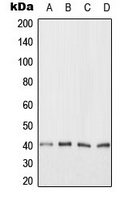 CARP / ANKRD1 Antibody - Western blot analysis of ANKRD1 expression in HeLa (A); Jurkat (B); NIH3T3 (C); H9C2 (D) whole cell lysates.
