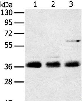 CARP / ANKRD1 Antibody - Western blot analysis of Mouse lung tissue, NIH/3T3 and hepg2 cell, using ANKRD1 Polyclonal Antibody at dilution of 1:400.