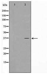 CARP / ANKRD1 Antibody - Western blot of COLO205 cell lysate using ANKRD1 Antibody