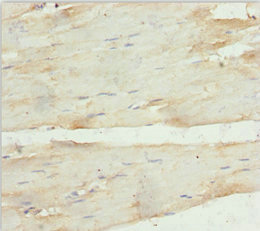 CARP / ANKRD1 Antibody - Immunohistochemistry of paraffin-embedded human skeletal muscle tissue at dilution 1:100