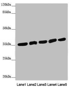 CARP / ANKRD1 Antibody - Western blot All Lanes: ANKRD1 antibody at 1.91 ug/ml Lane 1: Rat heart tissue Lane 2: Hela whole cell lysate Lane 3: 293T whole cell lysate Lane 4: Jurkat whole cell lysate Lane 5: HepG-2 whole cell lysate Secondary Goat polyclonal to rabbit IgG at 1/10000 dilution Predicted band size: 36 kDa Observed band size: 35 kDa