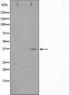 CARP / ANKRD1 Antibody - Western blot analysis on COLO205 cell lysates using ANKRD1 antibody. The lane on the left is treated with the antigen-specific peptide.