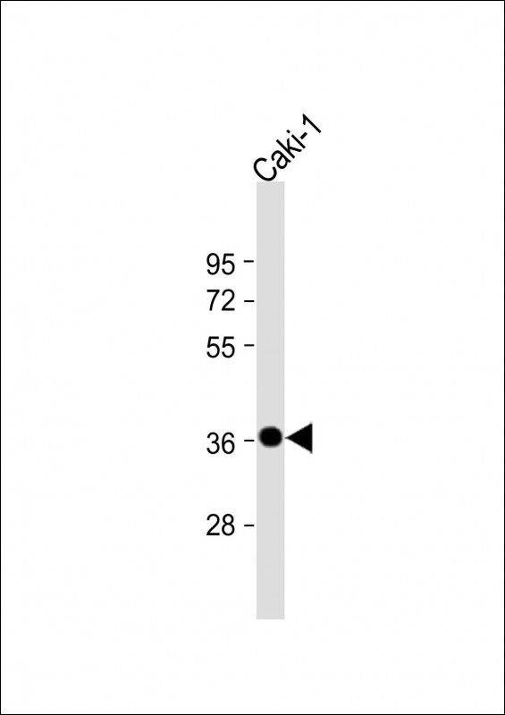 CARP / ANKRD1 Antibody - Anti-ANKRD1 Antibody (N-Term) at 1:2000 dilution + Caki-1 whole cell lysate Lysates/proteins at 20 µg per lane. Secondary Goat Anti-Rabbit IgG, (H+L), Peroxidase conjugated at 1/10000 dilution. Predicted band size: 36 kDa Blocking/Dilution buffer: 5% NFDM/TBST.