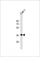 CARP / ANKRD1 Antibody - Anti-ANKRD1 Antibody (N-Term) at 1:2000 dilution + Caki-1 whole cell lysate Lysates/proteins at 20 µg per lane. Secondary Goat Anti-Rabbit IgG, (H+L), Peroxidase conjugated at 1/10000 dilution. Predicted band size: 36 kDa Blocking/Dilution buffer: 5% NFDM/TBST.
