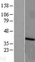 CARP / ANKRD1 Protein - Western validation with an anti-DDK antibody * L: Control HEK293 lysate R: Over-expression lysate