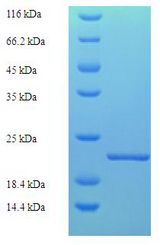 Car b 1 Isoforms 1A+1B Protein