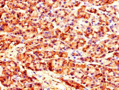 CARS1 / CARS Antibody - Immunohistochemistry of paraffin-embedded human pancreatic tissue using CARS Antibody at dilution of 1:100