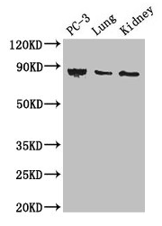 CARS1 / CARS Antibody - Western Blot Positive WB detected in: PC-3 whole cell lysate, Mouse lung tissue, Mouse kidney tissue All lanes: CARS antibody at 3µg/ml Secondary Goat polyclonal to rabbit IgG at 1/50000 dilution Predicted band size: 86, 83, 95 kDa Observed band size: 86 kDa