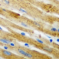 CARS1 / CARS Antibody - Immunohistochemical analysis of CARS staining in mouse heart formalin fixed paraffin embedded tissue section. The section was pre-treated using heat mediated antigen retrieval with sodium citrate buffer (pH 6.0). The section was then incubated with the antibody at room temperature and detected using an HRP conjugated compact polymer system. DAB was used as the chromogen. The section was then counterstained with hematoxylin and mounted with DPX.