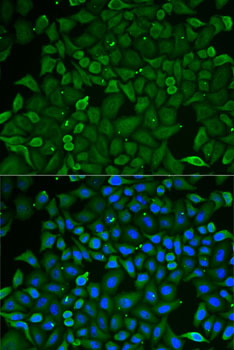 CARS1 / CARS Antibody - Immunofluorescence analysis of U2OS cells using CARS antibody. Blue: DAPI for nuclear staining.