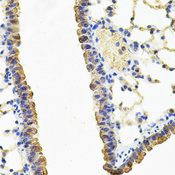 CARS1 / CARS Antibody - Immunohistochemistry of paraffin-embedded mouse lung using CARS Antibody at dilution of 1:100 (40x lens).