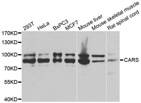 CARS1 / CARS Antibody - Western blot analysis of extracts of various cell lines, using CARS antibody at 1:1000 dilution. The secondary antibody used was an HRP Goat Anti-Rabbit IgG (H+L) at 1:10000 dilution. Lysates were loaded 25ug per lane and 3% nonfat dry milk in TBST was used for blocking. An ECL Kit was used for detection and the exposure time was 5s.