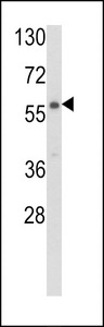CARS2 Antibody - Western blot of CARS2 Antibody in NCI-H460 cell line lysates (35 ug/lane). CARS2 (arrow) was detected using the purified antibody.