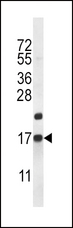 CARTPT / CART Antibody - CARTPT Antibody western blot of mouse heart tissue lysates (35 ug/lane). The CARTPT antibody detected the CARTPT protein (arrow).