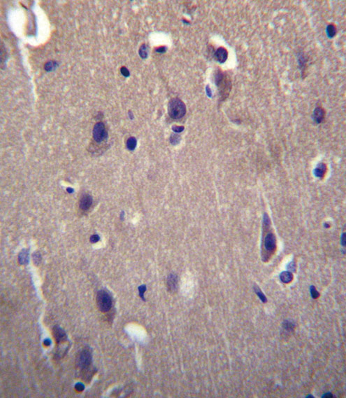 CARTPT / CART Antibody - CARTPT Antibody immunohistochemistry of formalin-fixed and paraffin-embedded human brain tissue followed by peroxidase-conjugated secondary antibody and DAB staining.