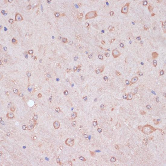 CARTPT / CART Antibody - Immunohistochemistry of paraffin-embedded Mouse brain using CARTPT Polyclonal Antibody at dilution of 1:100 (40x lens).