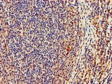 CASC1 Antibody - Immunohistochemistry of paraffin-embedded human lymph node tissue at dilution of 1:100