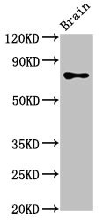 CASC1 Antibody - Western Blot Positive WB detected in:Rat brain tissue All Lanes:CASC1 antibody at 3.4µg/ml Secondary Goat polyclonal to rabbit IgG at 1/50000 dilution Predicted band size: 84,79,82,76 KDa Observed band size: 84 KDa