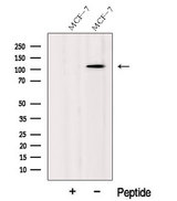 CASC3 / MLN51 Antibody - Western blot analysis of extracts of HeLa cells using MLN51/CASC3 antibody. The lane on the left was treated with blocking peptide.