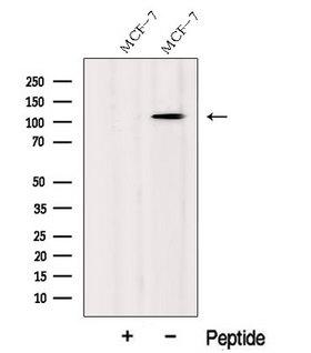 CASC3 / MLN51 Antibody - Western blot analysis of extracts of HeLa cells using MLN51/CASC3 antibody. The lane on the left was treated with blocking peptide.