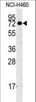 CASC3 / MLN51 Antibody - Western blot of anti-CASC3 Antibody (Y181) in NCI-H460 cell line lysates (35 ug/lane). CASC3(arrow) was detected using the purified antibody.