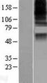 CASD1 Protein - Western validation with an anti-DDK antibody * L: Control HEK293 lysate R: Over-expression lysate