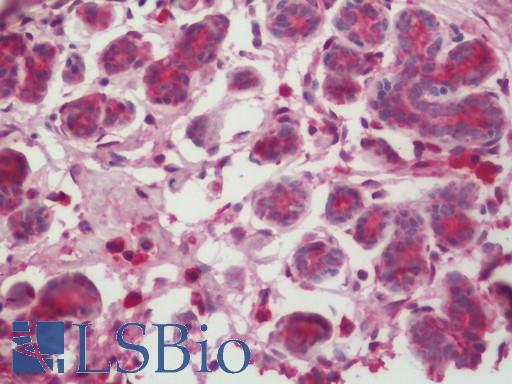 Casein Antibody - Human Breast: Formalin-Fixed, Paraffin-Embedded (FFPE).  This image was taken for the unconjugated form of this product. Other forms have not been tested.