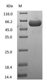 Casein Protein - (Tris-Glycine gel) Discontinuous SDS-PAGE (reduced) with 5% enrichment gel and 15% separation gel.