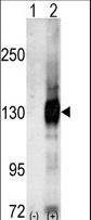 CASK Antibody - Western blot of CASK (arrow) using Cask Antibody. 293 cell lysates (2 ug/lane) either nontransfected (Lane 1) or transiently transfected with the CASK gene (Lane 2) (Origene Technologies).