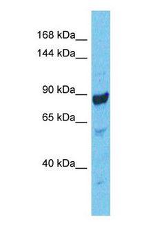 CASK Antibody - Western blot of CSKP Antibody with human COLO205 Whole Cell lysate.  This image was taken for the unconjugated form of this product. Other forms have not been tested.