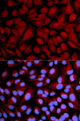 CASK Antibody - Immunofluorescence analysis of U2OS cells.