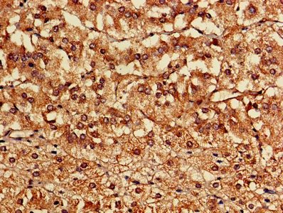 CASK Antibody - Immunohistochemistry of paraffin-embedded human adrenal gland tissue using CASK Antibody at dilution of 1:100