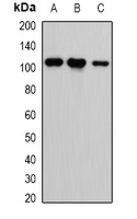 CASK Antibody - Western blot analysis of CASK expression in HEK293T (A); H460 (B); A549 (C) whole cell lysates.