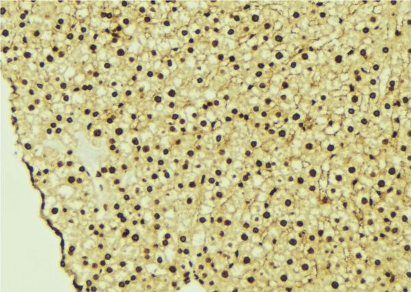 CASK Antibody - 1:100 staining mouse liver tissue by IHC-P. The sample was formaldehyde fixed and a heat mediated antigen retrieval step in citrate buffer was performed. The sample was then blocked and incubated with the antibody for 1.5 hours at 22°C. An HRP conjugated goat anti-rabbit antibody was used as the secondary.