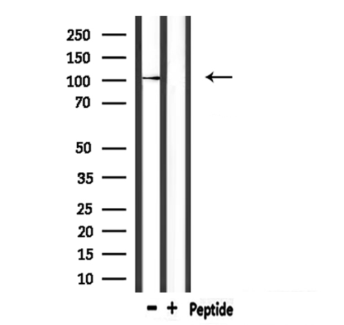 CASK Antibody - Western blot analysis of extracts of mouse brain tissue using CASK antibody.