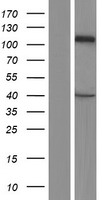CASK Protein - Western validation with an anti-DDK antibody * L: Control HEK293 lysate R: Over-expression lysate