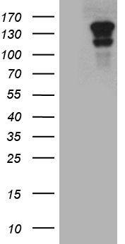 CASKIN2 Antibody - HEK293T cells were transfected with the pCMV6-ENTRY control. (Left lane) or pCMV6-ENTRY CASKIN2. (Right lane) cDNA for 48 hrs and lysed. Equivalent amounts of cell lysates. (5 ug per lane) were separated by SDS-PAGE and immunoblotted with anti-CASKIN2. (1:2000)