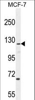 CASKIN2 Antibody - CASKIN2 Antibody western blot of MCF-7 cell line lysates (35 ug/lane). The CASKIN2 antibody detected the CASKIN2 protein (arrow).