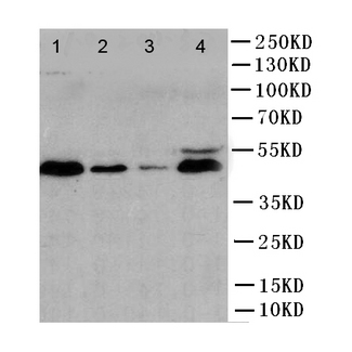 CASP1 / Caspase 1 Antibody - WB of CASP1 / Caspase 1 antibody. Lane 1: JURKAT Cell Lysate. Lane 2: RAJI Cell Lysate. Lane 3: CEM Cell Lysate . Lane 4: PC-12 Cell Lysate.