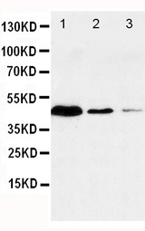 CASP1 / Caspase 1 Antibody - Anti-Caspase-1(P20) antibody, Western blotting Lane 1: JURKAT Cell Lysate Lane 2: RAJI Cell LysateLane 3: CEM Cell Lysate