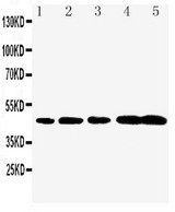 CASP1 / Caspase 1 Antibody - Caspase-1(P20) antibody Western blot. Lane 1: Rat Brain Tissue Lysate. Lane 2: Rat Spleen Tissue Lysate. Lane 3: Mouse Brain Tissue Lysate. Lane 4: Mouse Spleen Tissue Lysate. Lane 5: Mouse Testis Tissue Lysate.