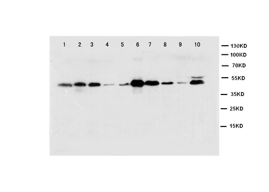 CASP1 / Caspase 1 Antibody - WB of CASP1 / Caspase 1 antibody. Lane 1: NIH Cell Lysate. Lane 2: MCF-7 Cell Lysate. Lane 3: HELA Cell Lysate. Lane 4: SMMC Cell Lysate. Lane 5: HT1080 Cell Lysate. Lane 6: SW620 Cell Lysate. Lane 7: JURKAT Cell Lysate. Lane 8: RAJI Cell Lysate. Lane 9: CEM Cell Lysate. Lane 10: PC-12 Cell Lysate.