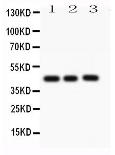 CASP1 / Caspase 1 Antibody - Anti-Caspase-1(P10) antibody, Western blotting All lanes: Anti CASP1(P10) at 0.5ug/ml Lane 1: MCF-7 Whole Cell Lysate at 40ugLane 2: HELA Whole Cell Lysate at 40ugLane 3: SW620 Whole Cell Lysate at 40ugPredicted bind size: 45KD Observed bind size: 45KD