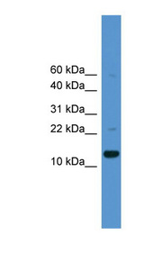 CASP1 / Caspase 1 Antibody - CASP1 / Caspase 1 antibody Western blot of 721_B cell lysate. This image was taken for the unconjugated form of this product. Other forms have not been tested.