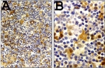 CASP1 / Caspase 1 Antibody - Formalin-fixed, paraffin-embedded section of human reactive lymph node stained for Caspase-1 expression (antibody) using a DAB chromogen and Hematoxylin counterstain. B is a higher magnification of A. Staining in macrophages is observed.