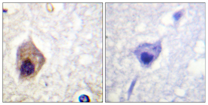 CASP1 / Caspase 1 Antibody - Immunohistochemistry analysis of paraffin-embedded human brain tissue, using Caspase 1 Antibody. The picture on the right is blocked with the synthesized peptide.