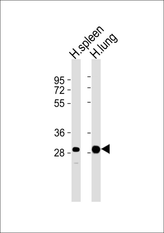 CASP1 / Caspase 1 Antibody - All lanes : Anti-Caspase 1 Antibody at 1:1000 dilution Lane 1: H.spleen tissue lysates Lane 2: H.lung tissue lysates Lysates/proteins at 20 ug per lane. Secondary Goat Anti-Rabbit IgG, (H+L),Peroxidase conjugated at 1/10000 dilution Predicted band size : 45 kDa Blocking/Dilution buffer: 5% NFDM/TBST.