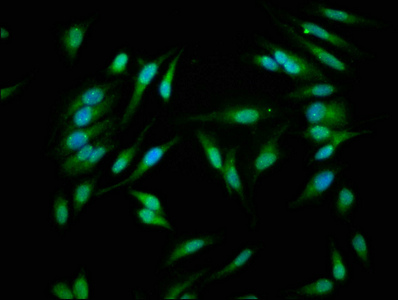 CASP1 / Caspase 1 Antibody - Immunofluorescence staining of Hela cells with CASP1 Antibody at 1:266, counter-stained with DAPI. The cells were fixed in 4% formaldehyde, permeabilized using 0.2% Triton X-100 and blocked in 10% normal Goat Serum. The cells were then incubated with the antibody overnight at 4°C. The secondary antibody was Alexa Fluor 488-congugated AffiniPure Goat Anti-Rabbit IgG(H+L).